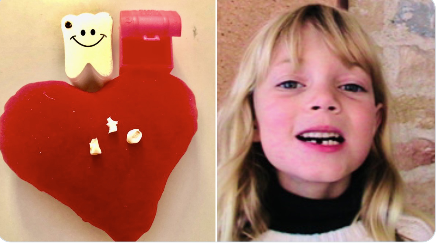 Travel memories soultravelers3 losing baby teeth around the world 
