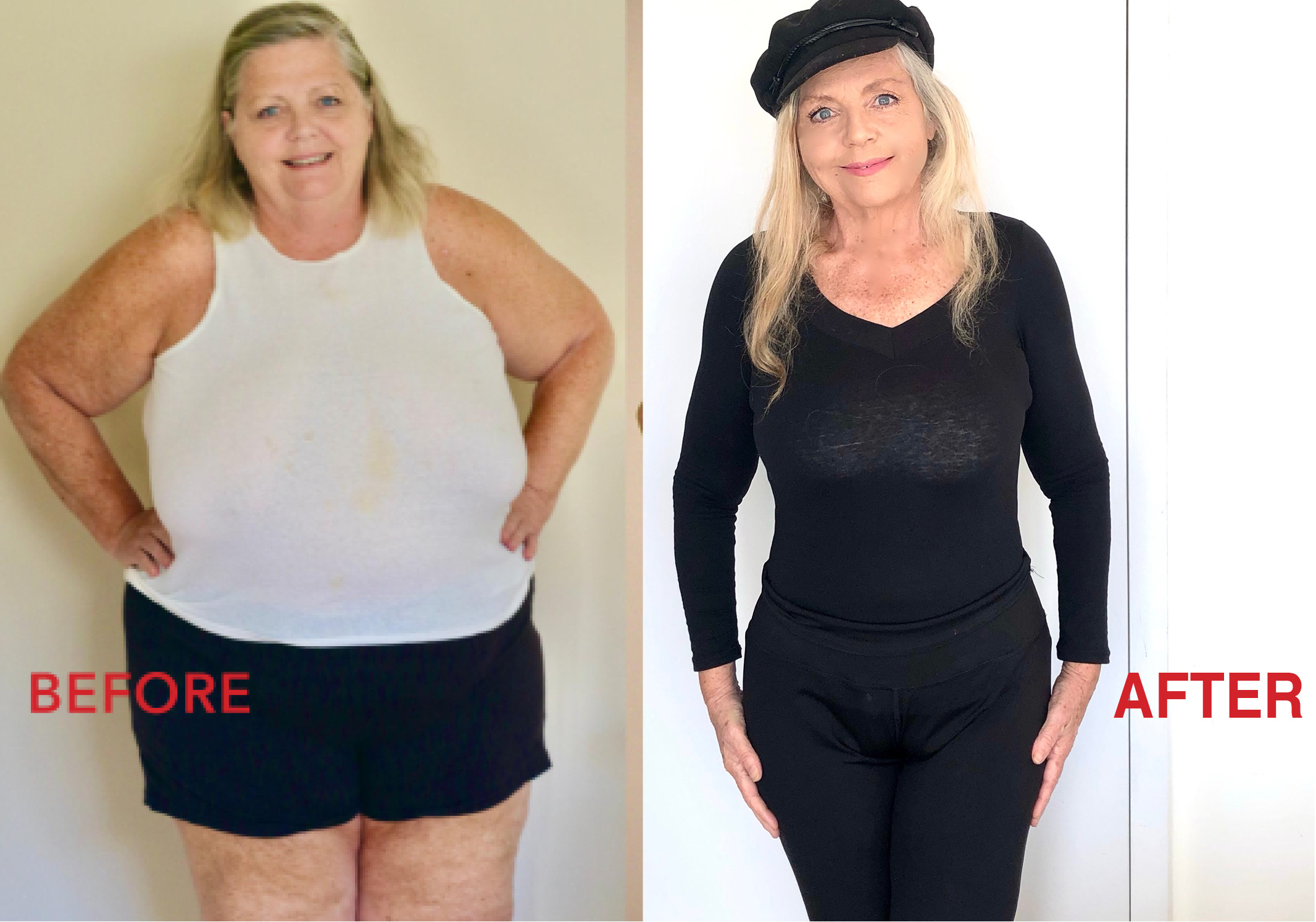 Weightloss transformation! How I lost 170lbs:77 Kilos at 70! Weightloss transformation! How I lost 170lbs:77 Kilos at 70!
