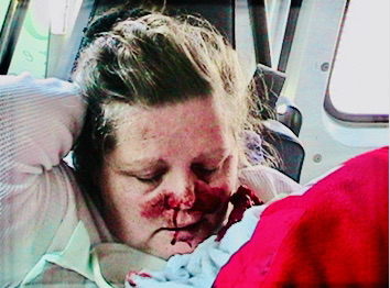 How to Handle Injury Illness Covid While Traveling Abroad! nose bleed to death bleeder ibruprofen How to Handle Injury Illness Covid While Traveling Abroad! nose bleed to death bleeder ibruprofen